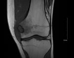 4 NMSP Circulation A21 - Bone case B5.jpg